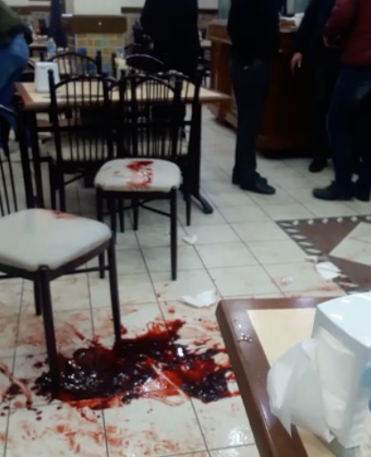 Çorbacıda iki bacağa husumet kurşunu