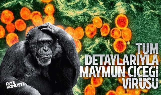 Maymun çiçeği (Mpox) virüsü nedir, nasıl bulaşır, hastalığın tedavisi var mı? İşte tüm detaylar…