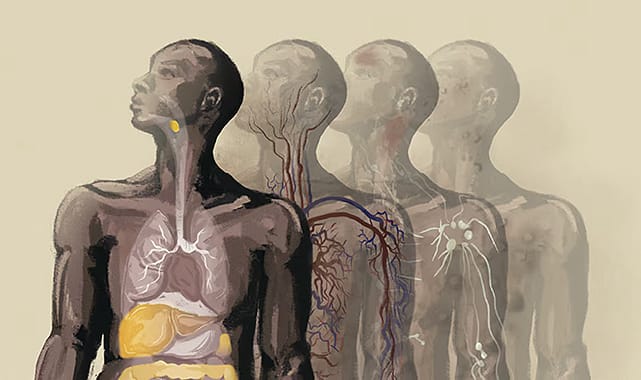 Vücudun Mpox ile savaşı! Maymun çiçeği virüsü insana nasıl bulaşıyor?