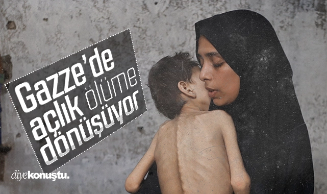 Gazze’de açlık ölüme dönüşüyor: Yavaş yavaş ölüyoruz, bizi kurtarın