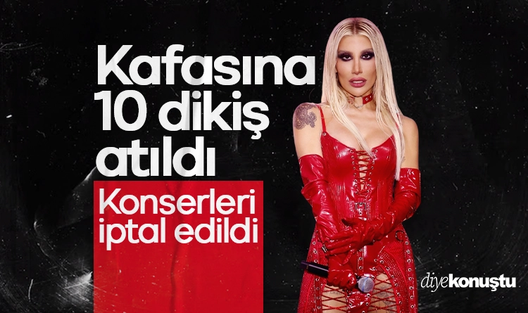 Kafasına 10 dikiş atıldı, konserleri iptal edildi