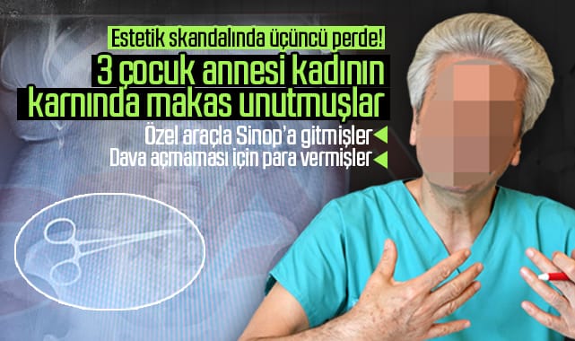 Samsun’daki estetik skandalında üçüncü perde: 3 çocuk annesi kadının karnında makas unutmuşlar