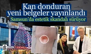 Estetik Skandali 4 Haber Manset 2024 2