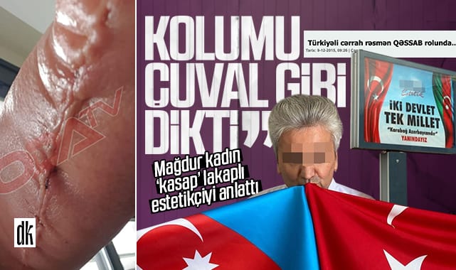 Samsun’da Afgan doktorların çalıştırıldığı estetik kliniğinde skandallar sürüyor: ‘Kasap’ lakaplı estetikçi kadının kolunu çuval gibi dikmiş!