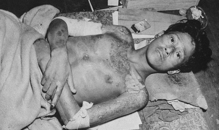 Hiroşima'da neler yaşandı? 6 Hirosimada neler yasandi 1