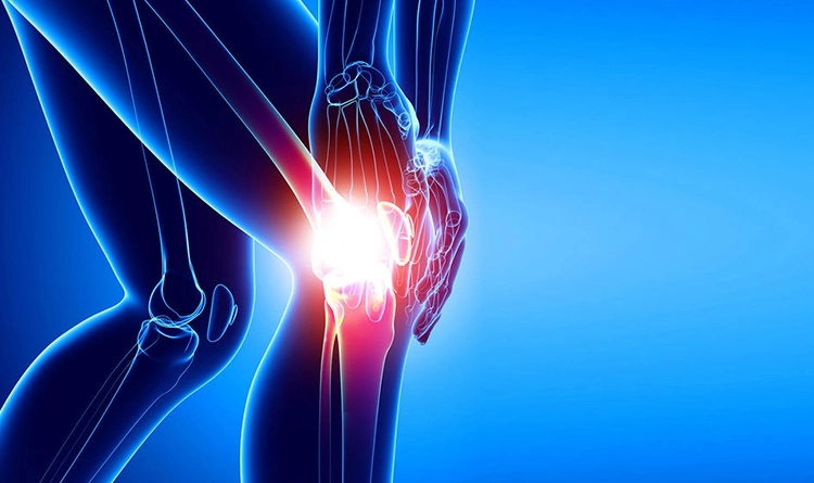 Ön çapraz bağ kopması: Belirtiler, tedavi seçenekleri, ameliyat ve iyileşme süreci 1 On capraz bag kopmasi